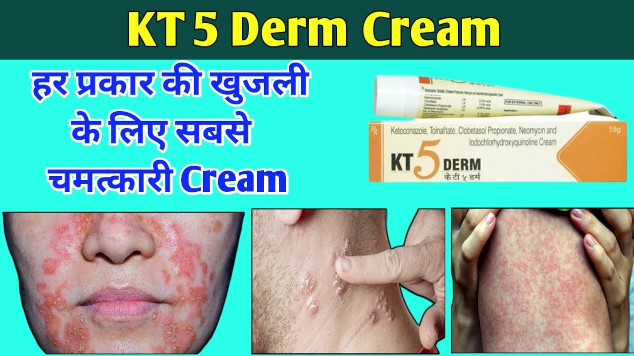 kt 5 derm cream uses in hindi || kt 5 derm se kya hota hai || kt 5 derm #no.1Video