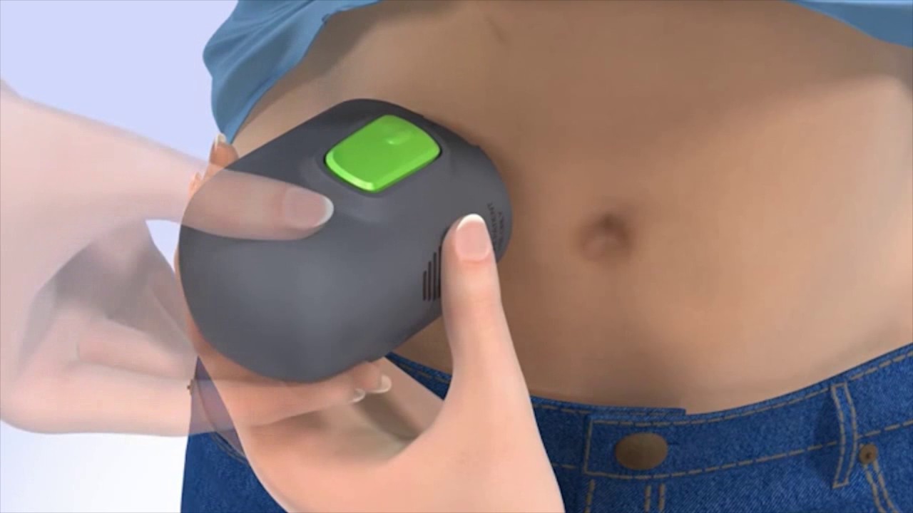 Medtronic - Jak prawidłowo założyć sensor i podłączyć Guardian Connect (CGM)?