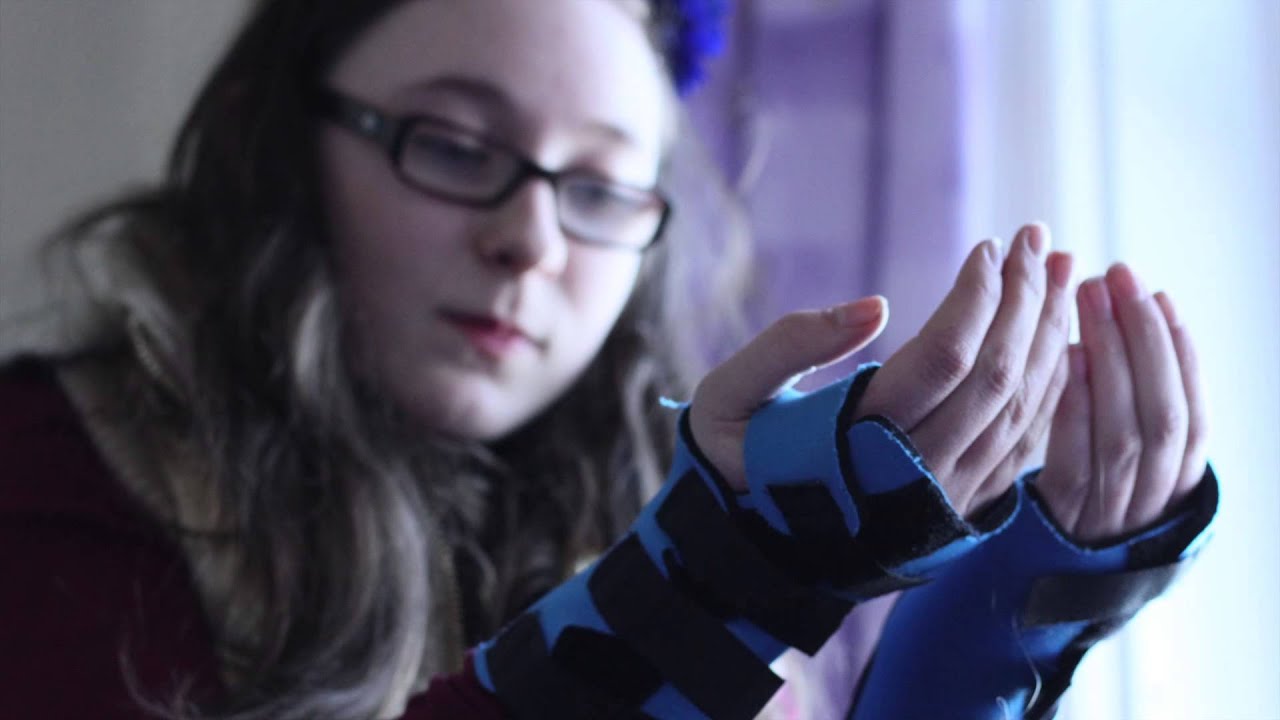 'Life in Pictures' : Ehlers-Danlos Syndrome