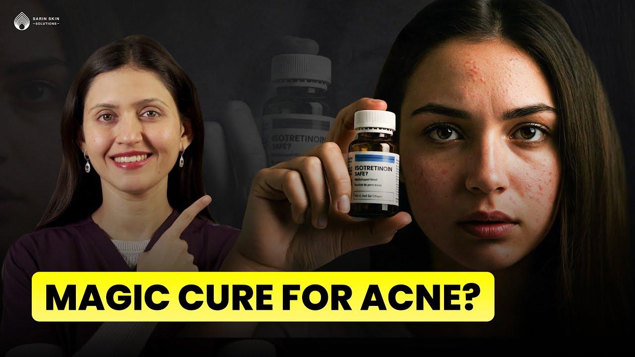Isotretinoin For Acne | Safety and Results | Complete Information