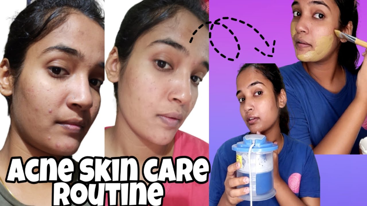 Skin care routine For Acne prone skin || Beauty With Manisha 2020