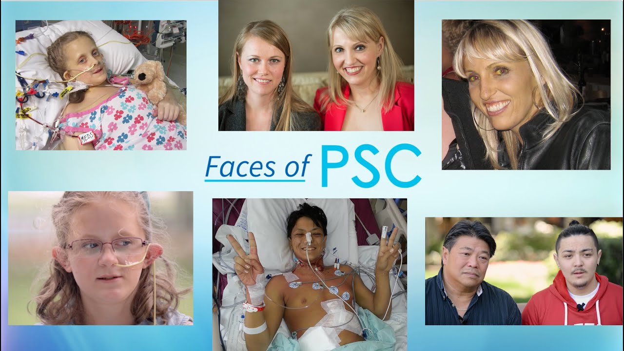 Faces of PSC