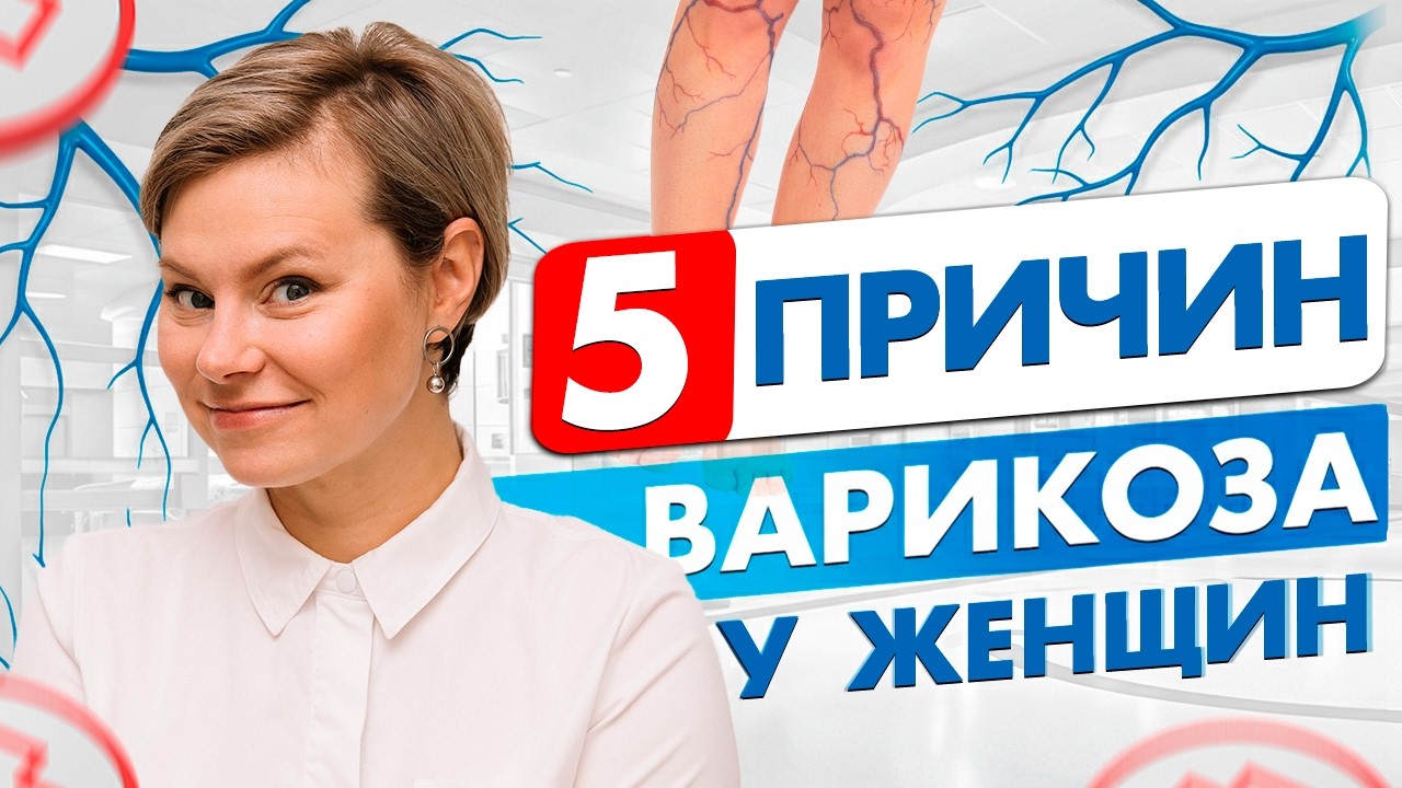 Почему появляется варикоз? 5 причин. Гинеколог Екатерина Волкова