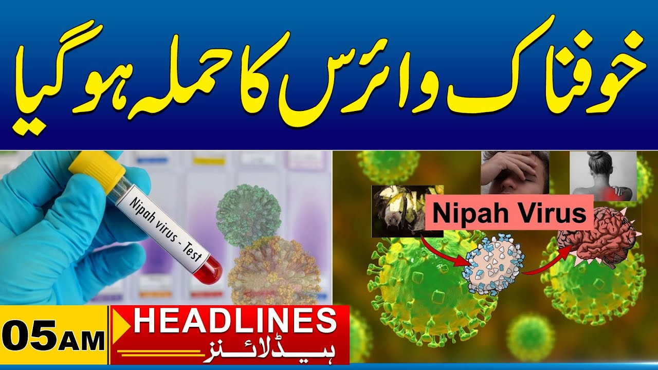 Sad News | 05am News Headlines I 03 Feb 2026 I City 41