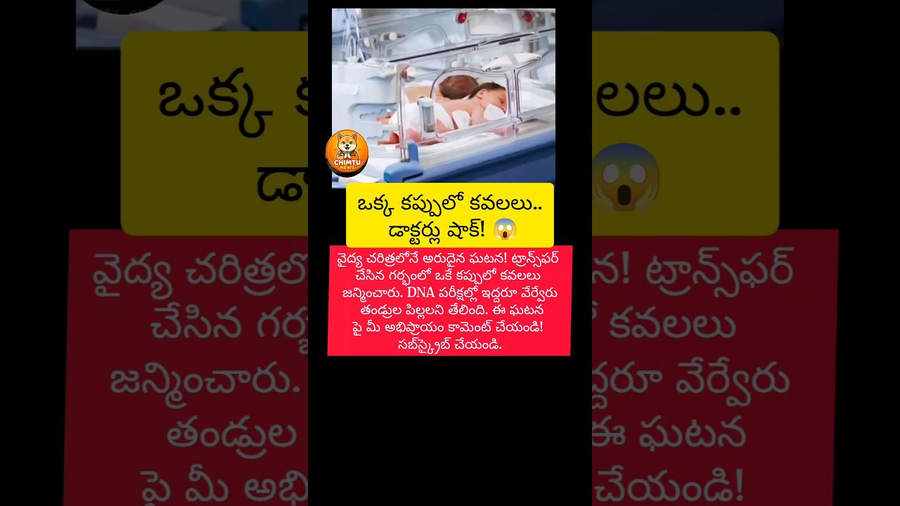 #twins #baby #telugunews #apnews