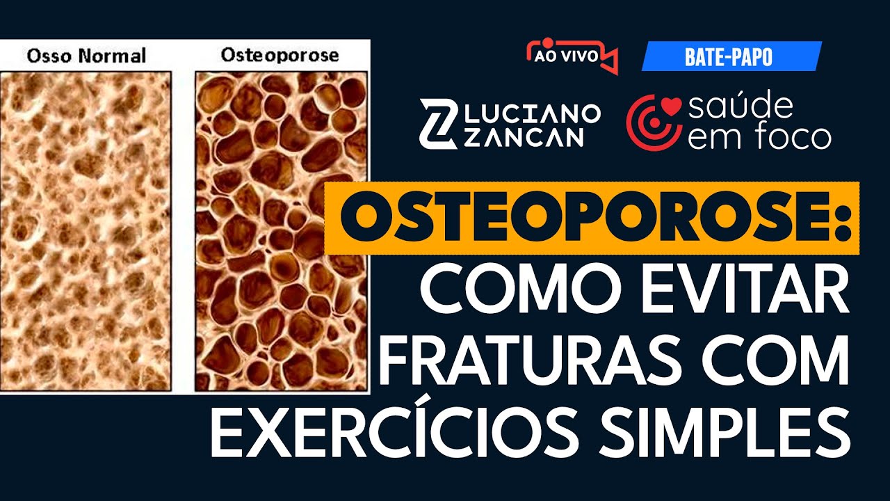 LIVE Osteoporose: Como Evitar Fraturas com Exercícios Simples em Casa