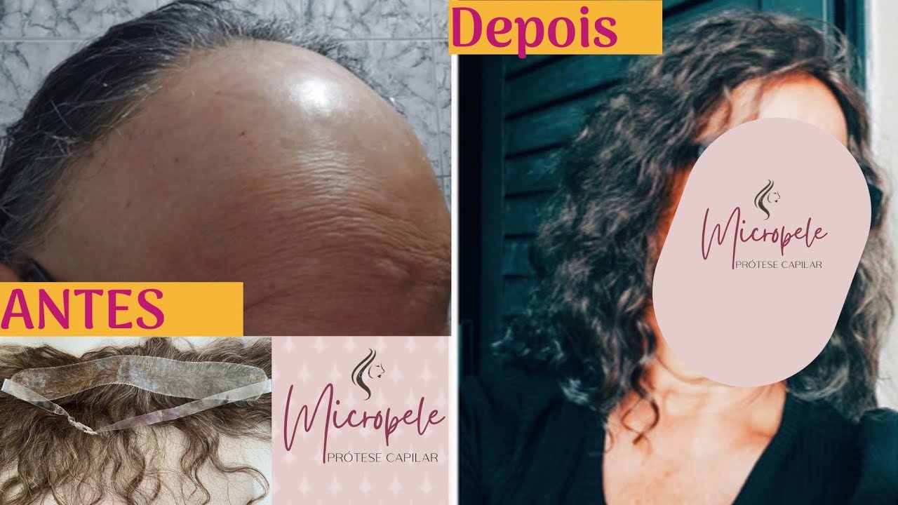 Faixa Capilar Frontal em Micropele e Cabelo Brasileiro