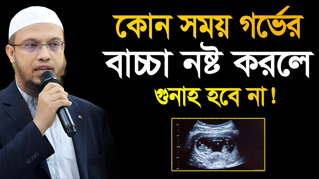 কতদিনের বাচ্চা নষ্ট করা জায়েয আছে? বাচ্চা নষ্ট করলে গুনাহ হবে না? শায়েখ আহমাদুল্লাহ Ahmadullah