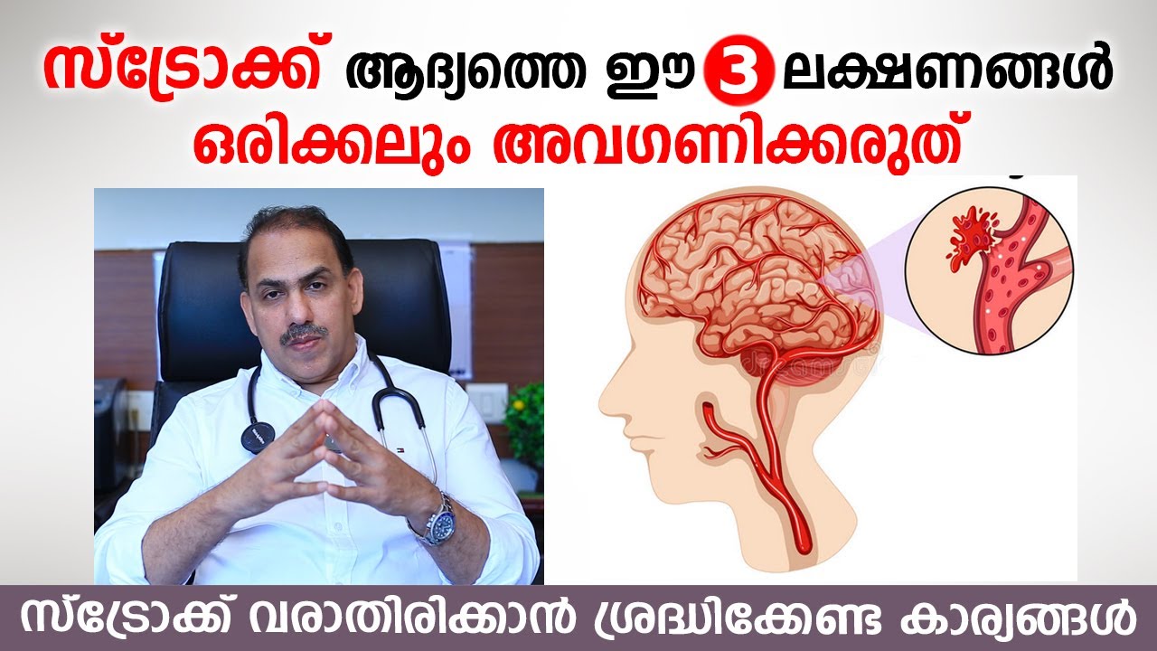 സ്ട്രോക്ക് ആദ്യത്തെ ഈ 3 ലക്ഷണങ്ങൾ ഒരിക്കലും അവഗണിക്കരുത് | Stroke Symptoms | Dr Ummer karadan