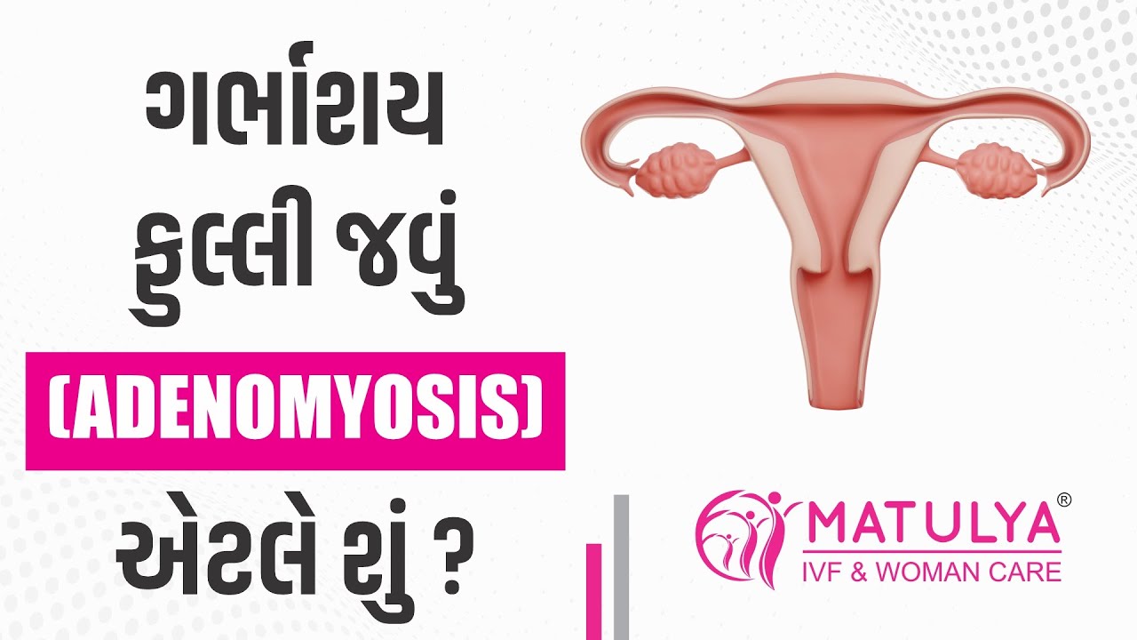 ગર્ભાશય ફુલ્લી જવું એટલે શું ? | Adenomyosis | Dr.Hitesh Italiya | Matulya IVF & Woman care | Surat