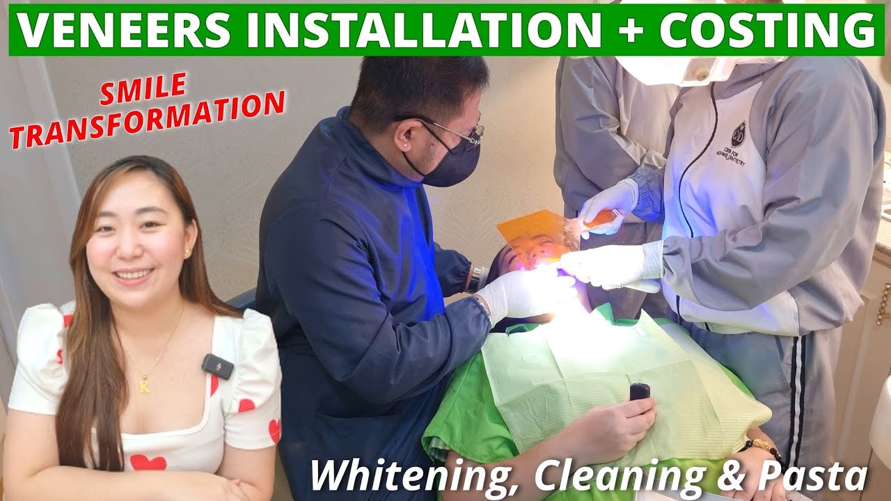 Veneers Installation & Costing! Ang Ganda at Sulit (Magkano Ang Whitening, Cleaning & Pasta) LEGIT