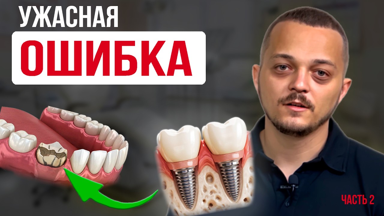 Подлые стоматологи! Реальная СХЕМА развода, о которой молчат! Дикие ПОСЛЕДСТВИЯ ошибок ИМПЛАНТАЦИИ!