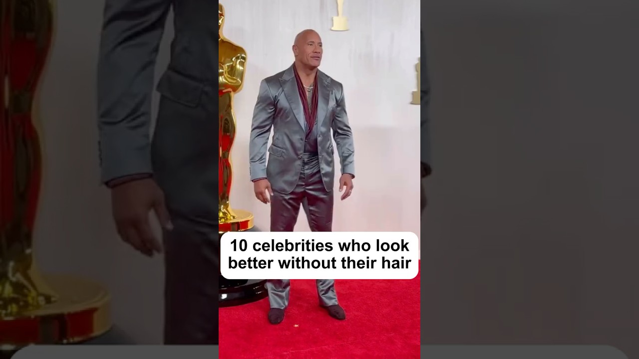 Знаменитости, которым лучше без волос 💀. 