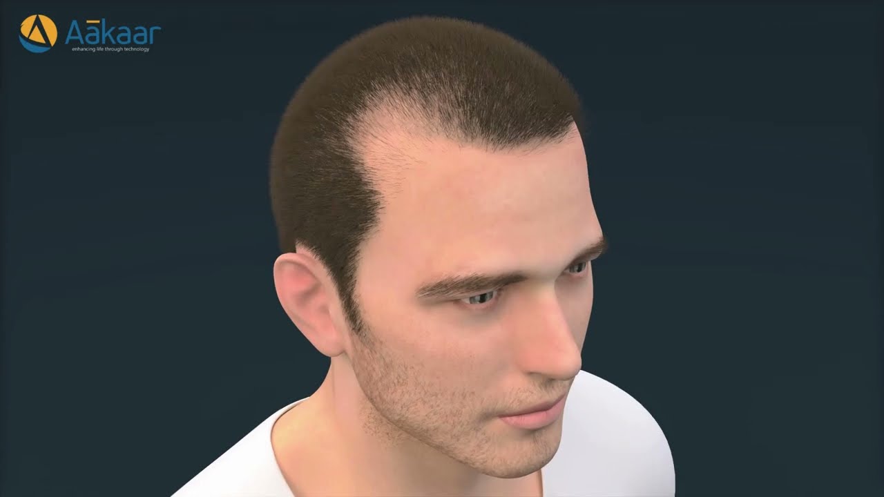 Regenera Activa watch our exclusive procedure video