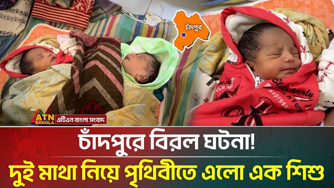 চাঁদপুরে বিরল ঘটনা! দুই মাথা নিয়ে পৃথিবীতে এলো এক শি/শু | Chandpur | Twins Baby | ATN Bangla News