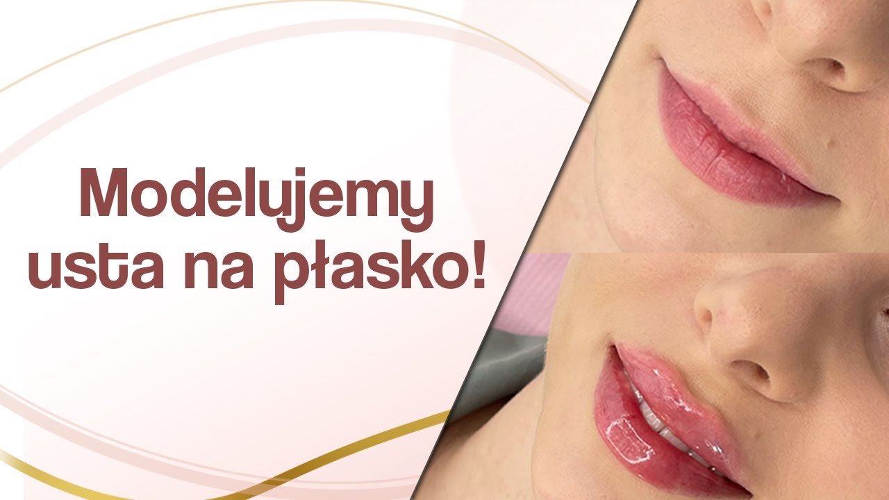 MODELUJEMY USTA na płasko kwasem hialuronowym!