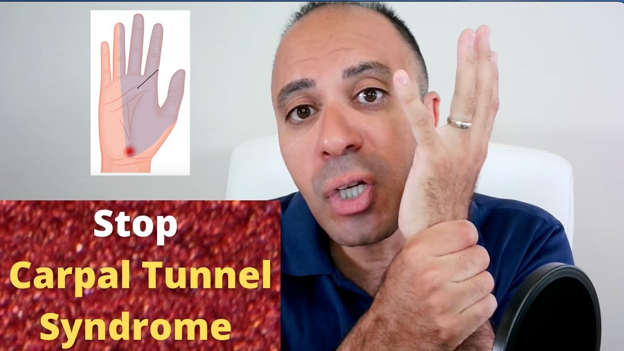 Stop Carpal Tunnel Syndrome Naturally: Symptoms, Causes, Healing Cycle & Treatment
