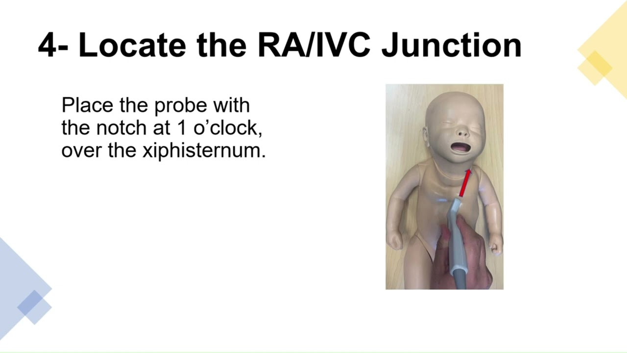 POCUS UVC