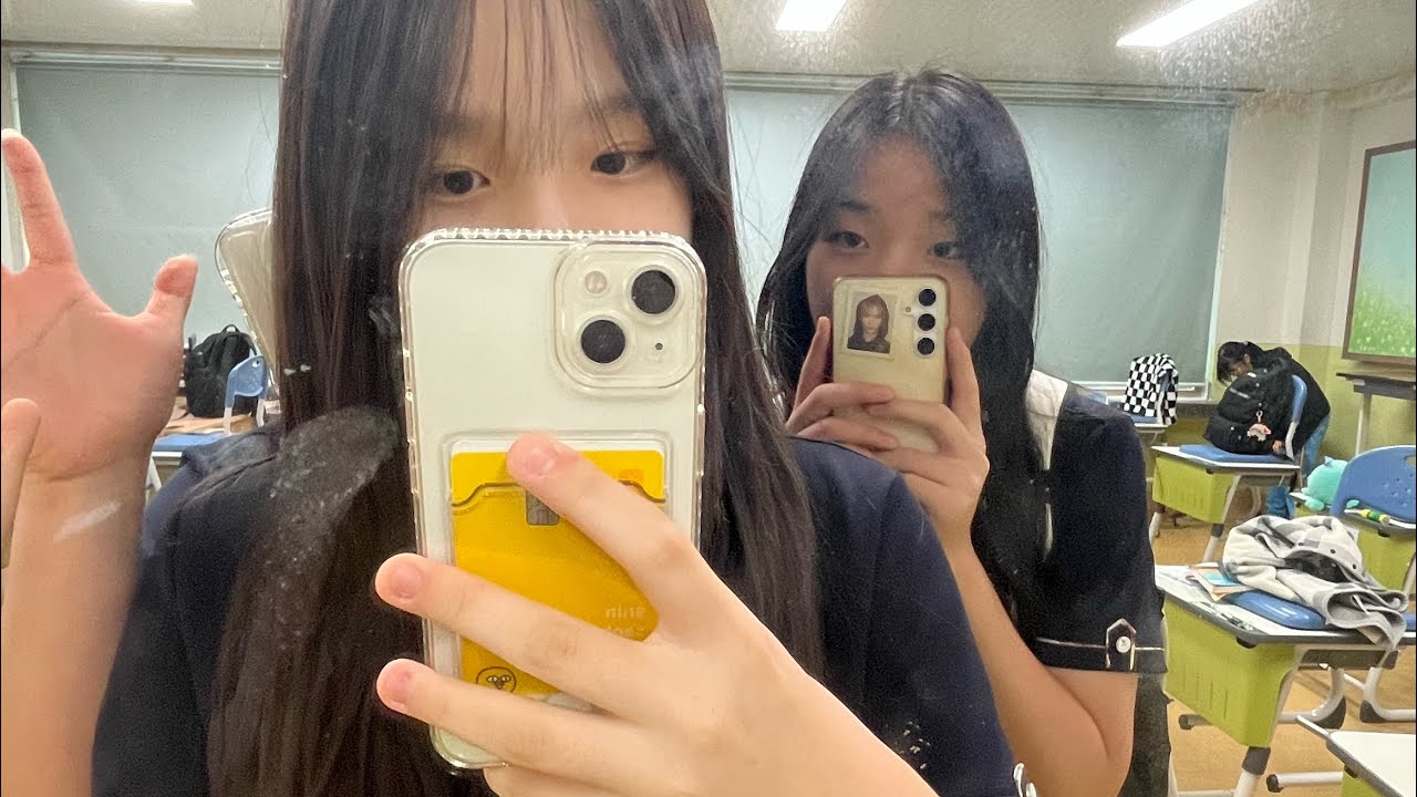 [일상 브이로그] 발목 삐었어요