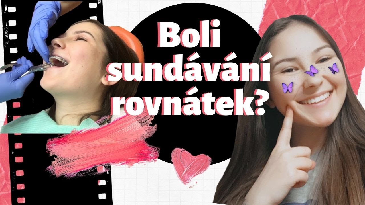 BOLÍ SUNDÁNÍ ROVNÁTEK?#3 /the Alas