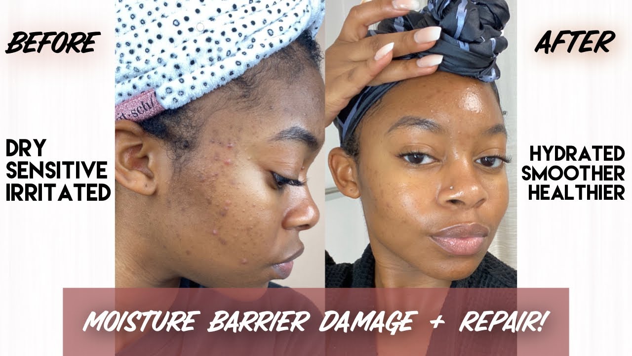 Я ИСПОРТИЛА СВОЮ КОЖУ!! | Как я восстановила свой барьер влаги + Советы по настоящей чистой коже