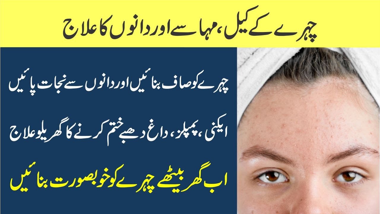 Acne Treatment in urdu | Chehray k dano ka ilaj | Dr jahangir Yasir