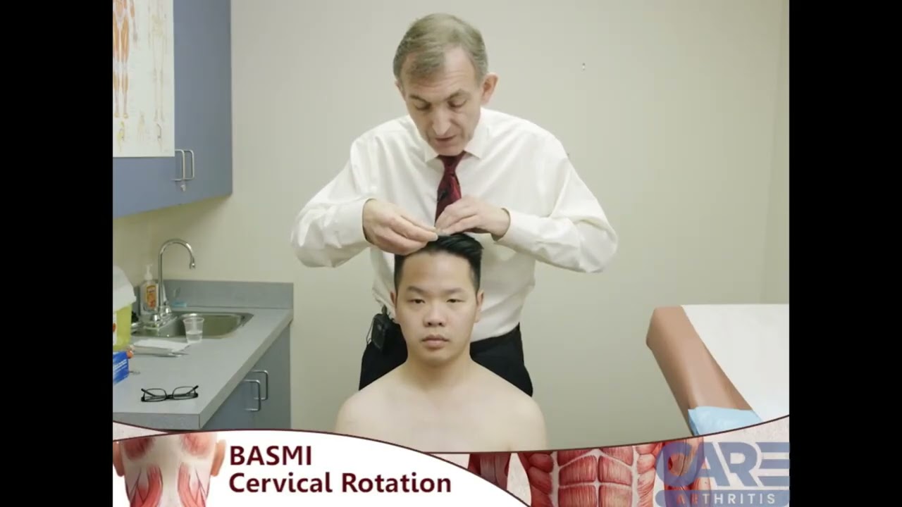 BASMI Cervical Rotation (Ukrainian)