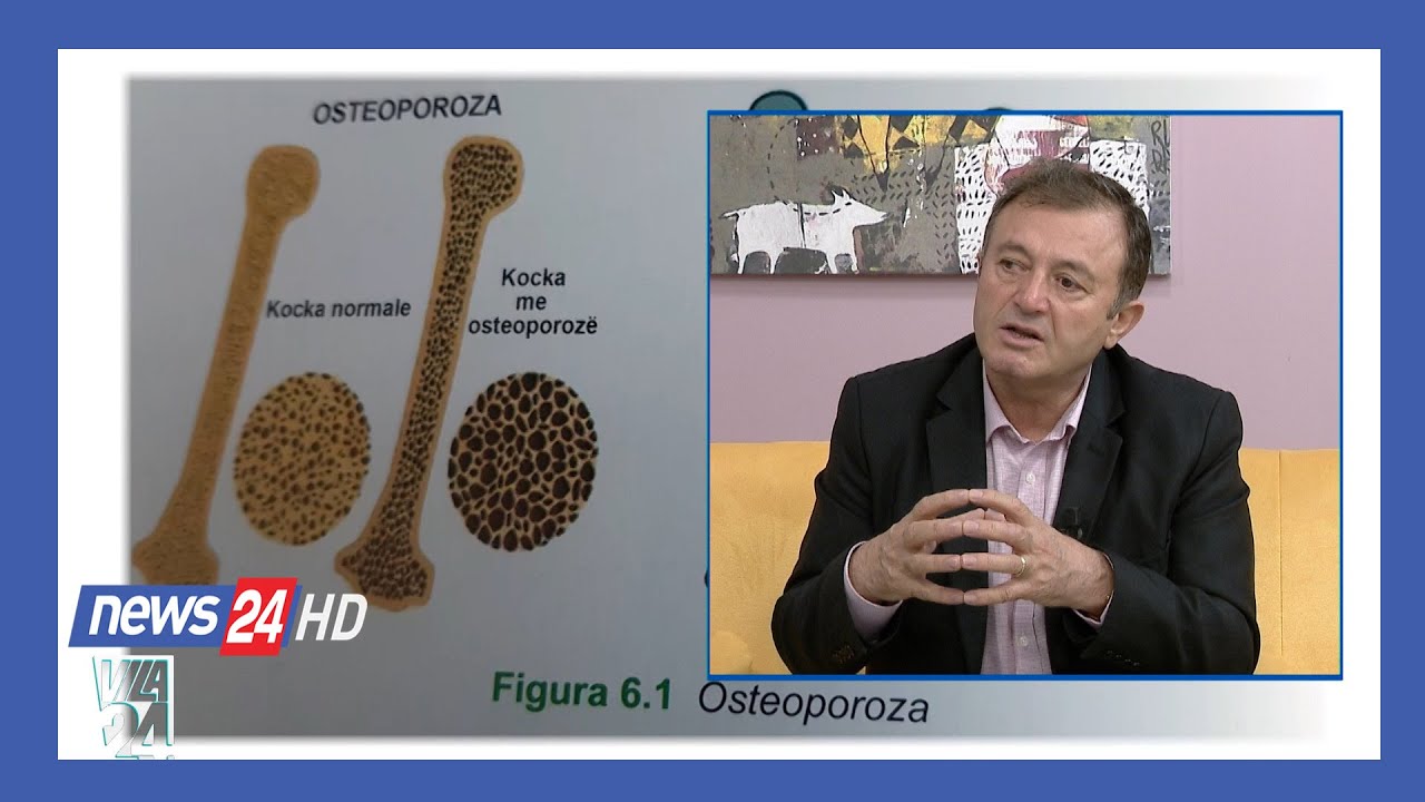 “Osteoporoza, frika nga thyerja e kocka. Trajtimi bimor nga Ylli Merja