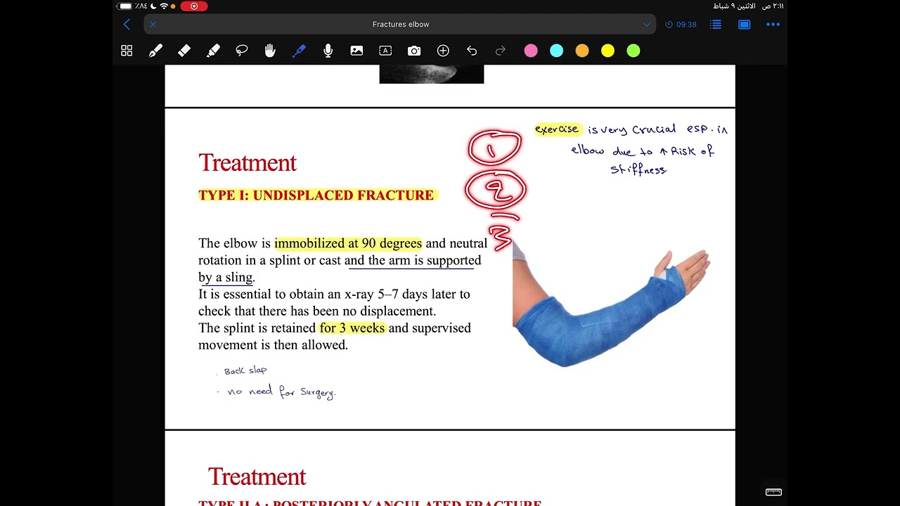 Orthopaedic / Elbow fractures 