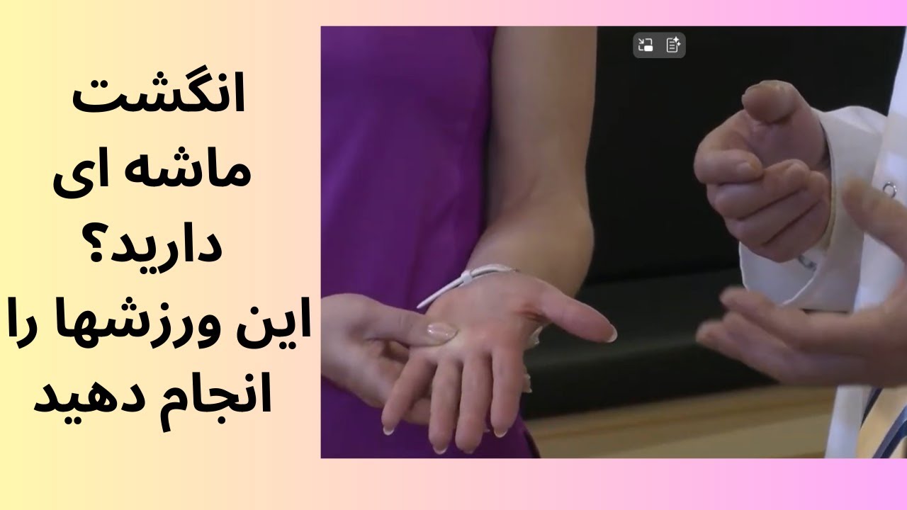 TV 362: trigger finger physiotherapy management (English subs) فیزیوتراپی انگشت ماشه‌ ای و‌ تمرینات