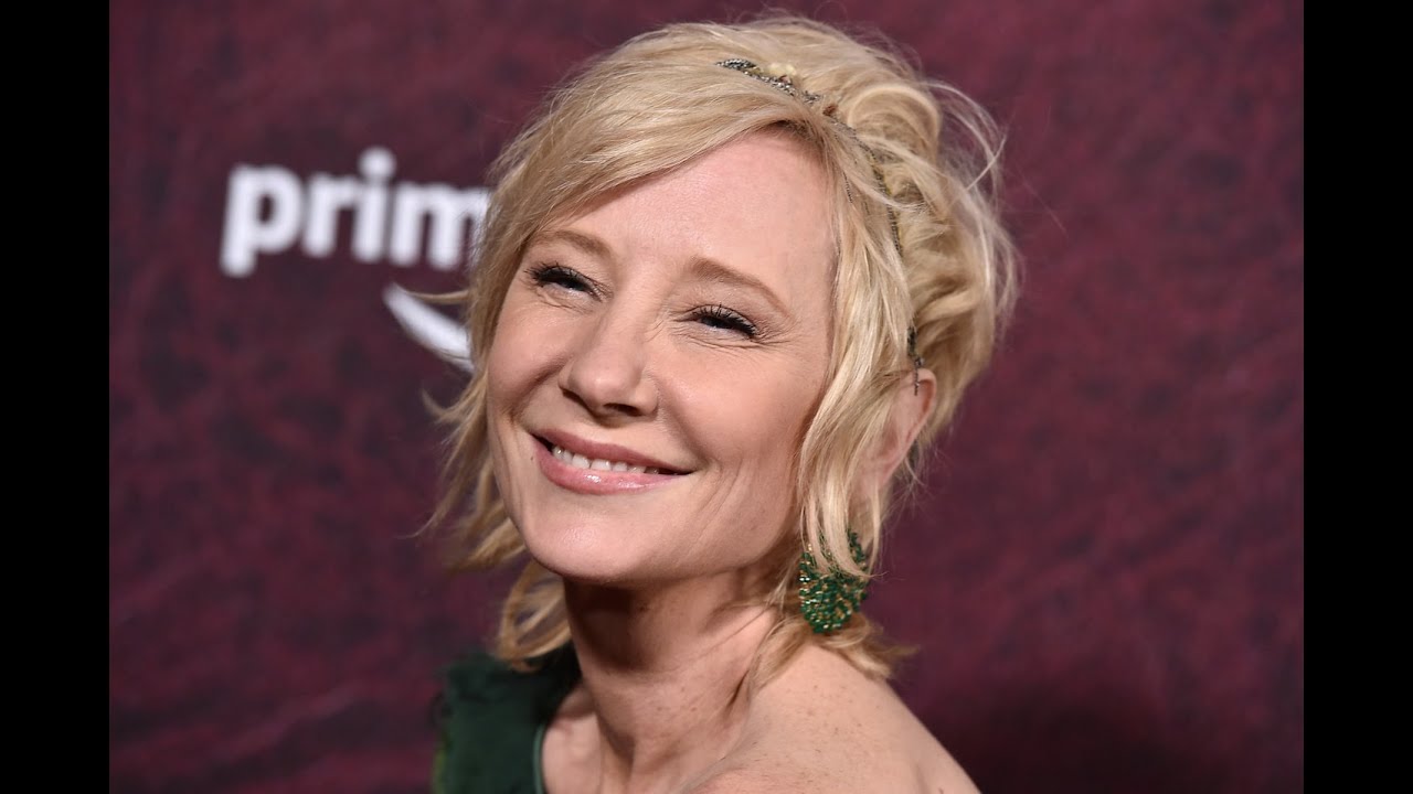 Actress Anne Heche is in a coma after crashing car into home rep says