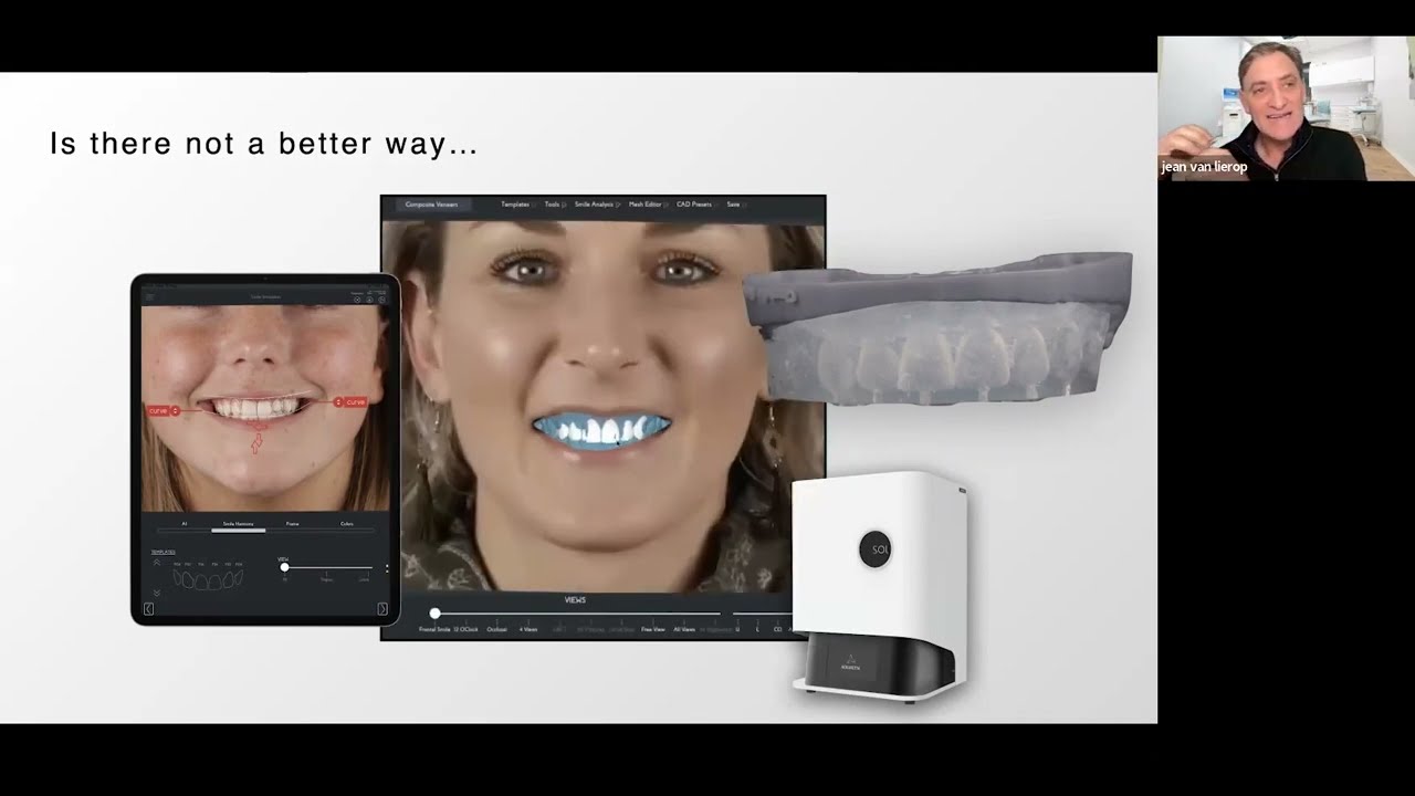 From Smile Design to Smile Rehabilitation. The power of a digital workflow in your own hands.