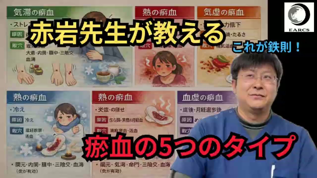 【赤岩先生が解説】瘀血の5つのタイプ