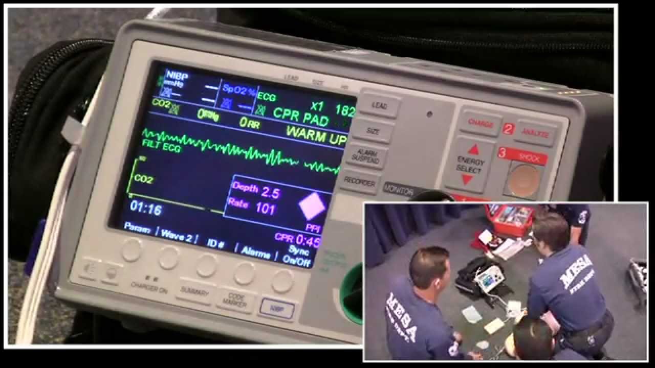 MFMD Demonstrates Minimally Interrupted Cardiac Resuscitation (MICR)