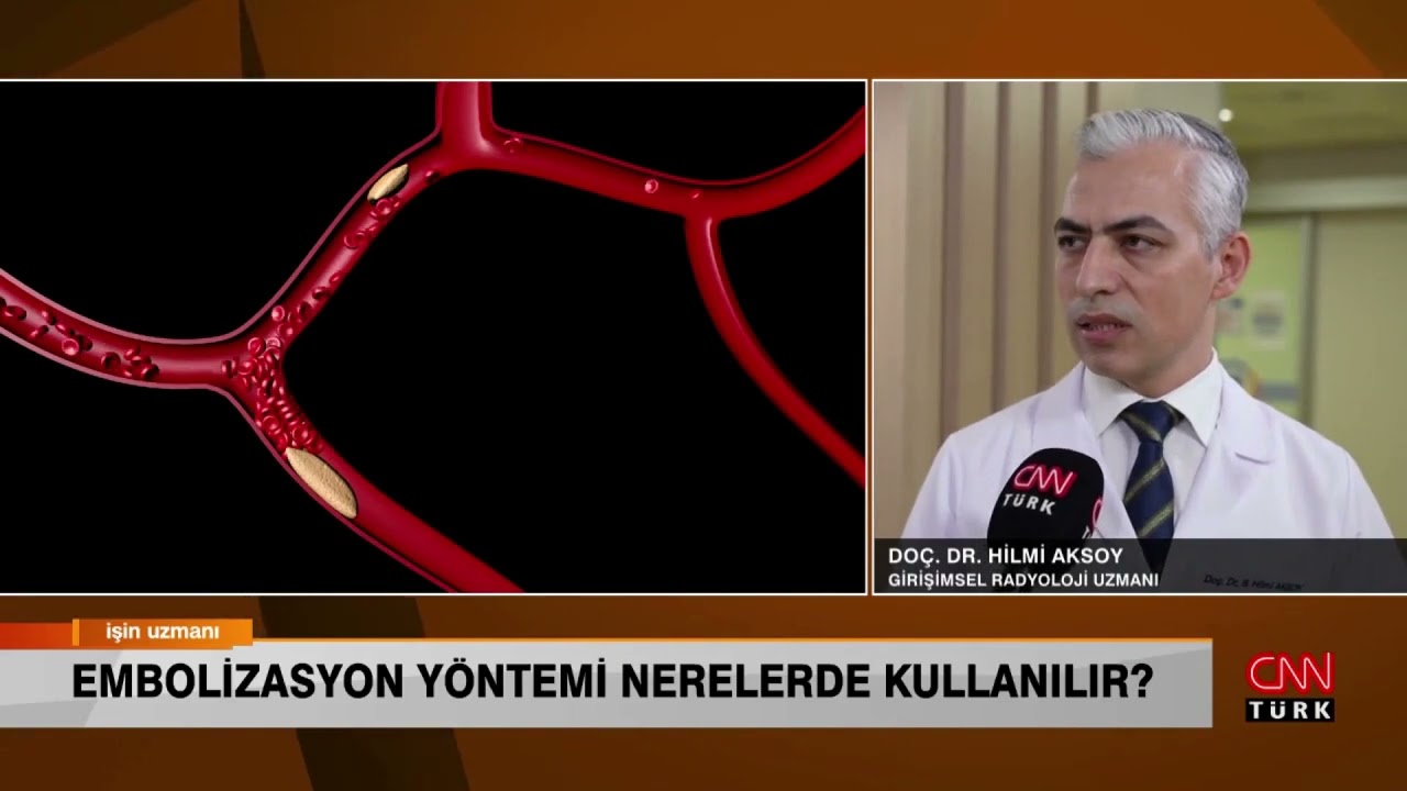 Embolizasyon Yöntemi Nerelerde Kullanılır?
