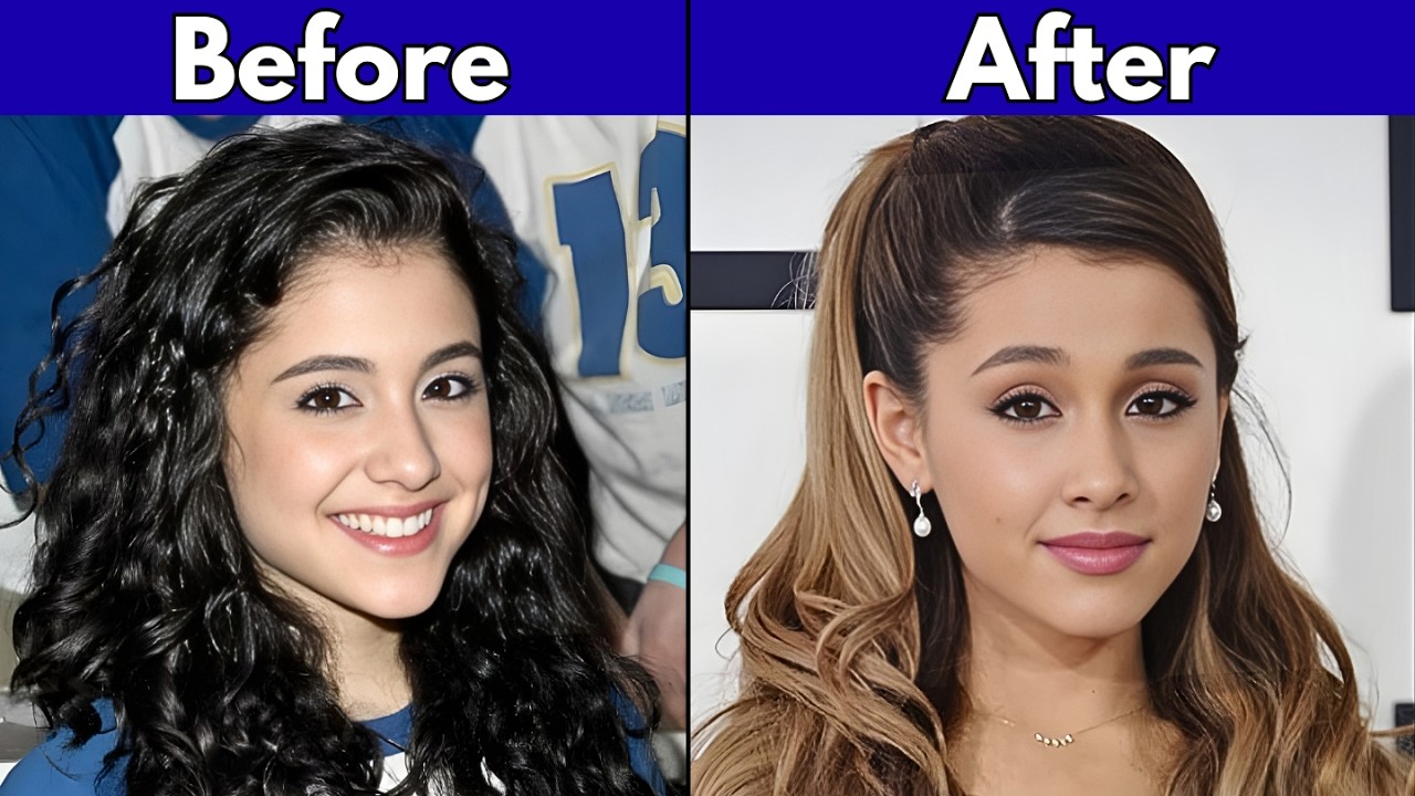 Hollywood Secrets Exposed: 30+ Celebrities Before and After Plastic Surgery