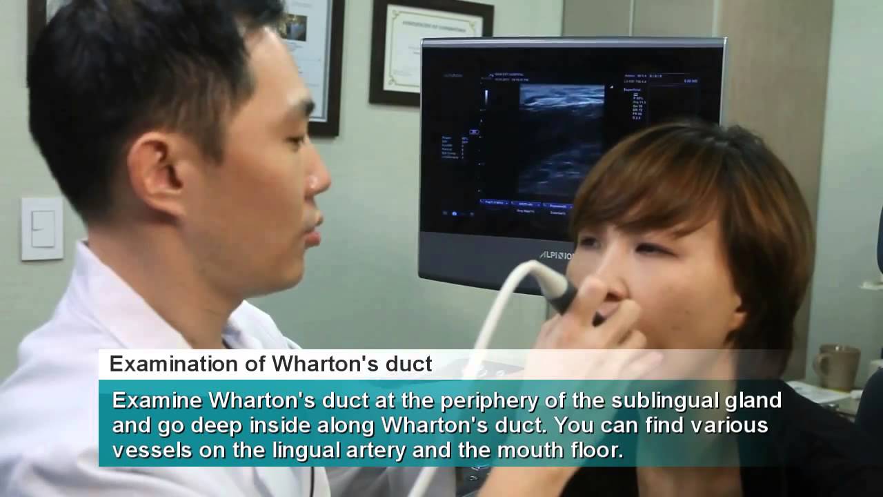 Ultrasound Intra Oral Scanning Procedure