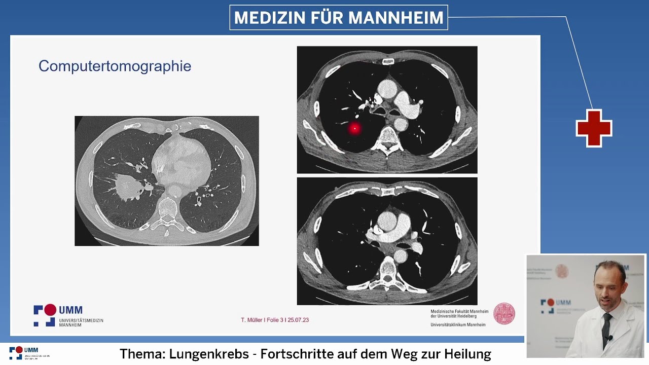 Vom Röntgenbild bis zur Therapie - moderne Diagnostik bei Lungenkrebs