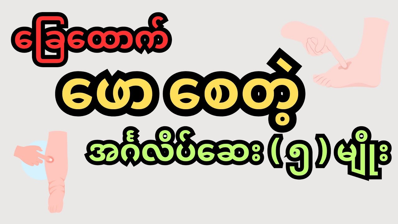 ခြေထောက်ဖောစေတဲ့ အင်္ဂလိပ်ဆေး ( ၅ ) မျိုး - leg oedema
