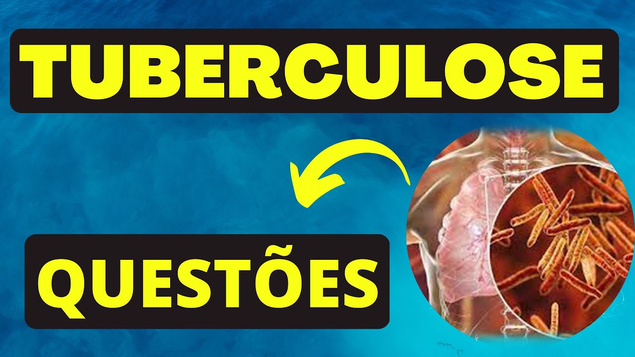 TUBERCULOSE  - RESOLUÇÃO DE QUESTÕES