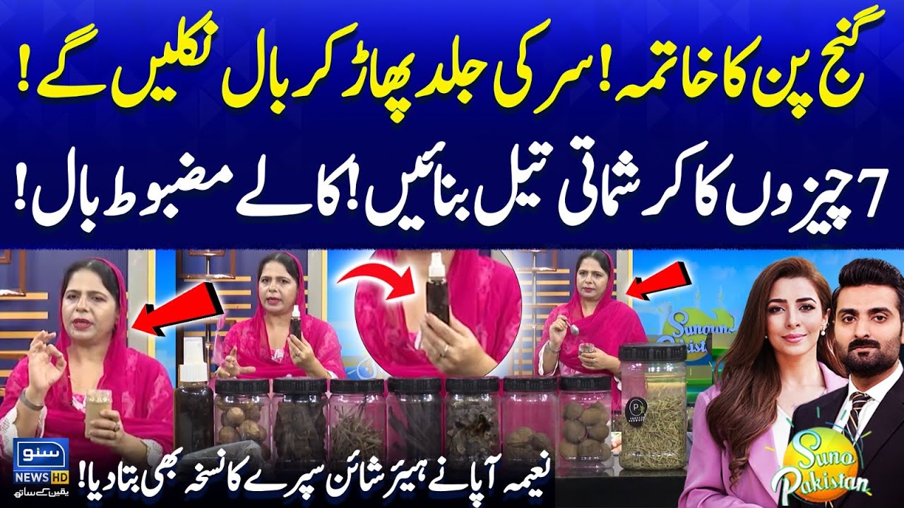Hair Fall & Baldness Solution | Try This Charismatic Oil | Naeema Apa K Totkay | Suno PakistanEP628