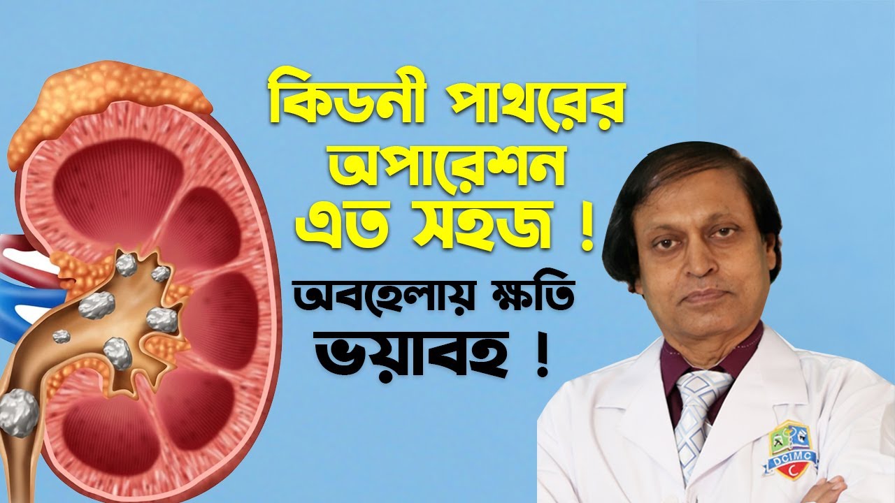 ঝুঁকিহীন কিডনী পাথরের চিকিৎসা ! অবহেলায় ক্ষতি অপূরনীয়। হাসপাতাল