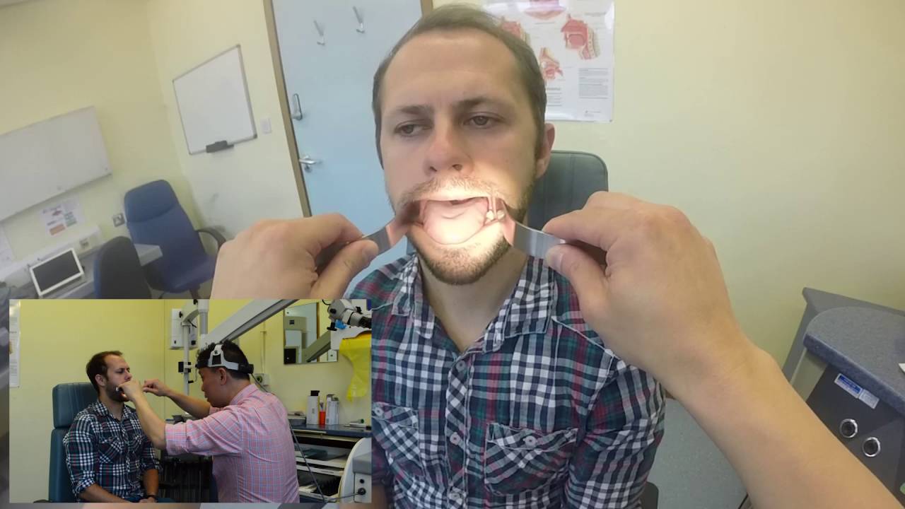 Examination of the Oral Cavity