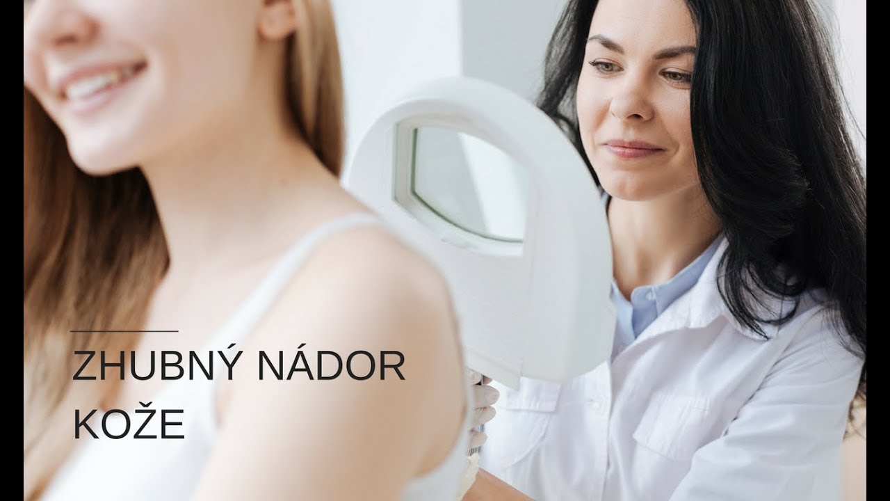 Zhubný nádor kože - malígny melanóm