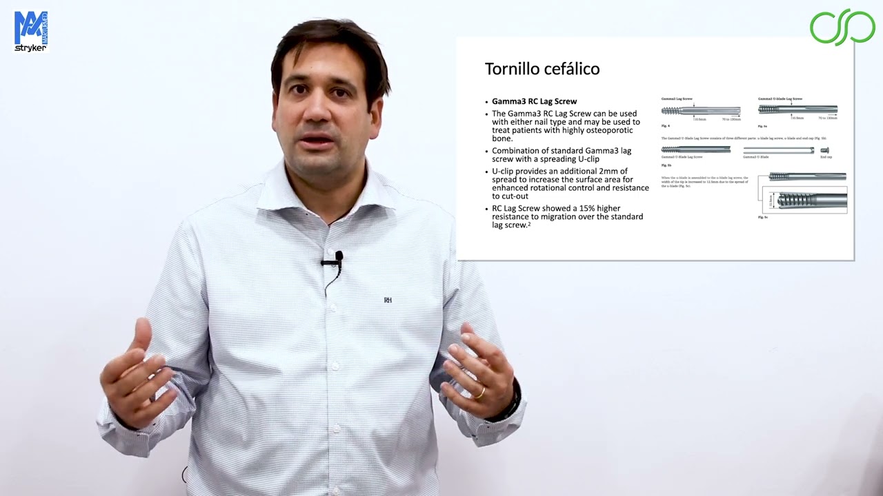 Tips del Clavo de Gamma 3 de Stryker - Dr. Oscar Ares