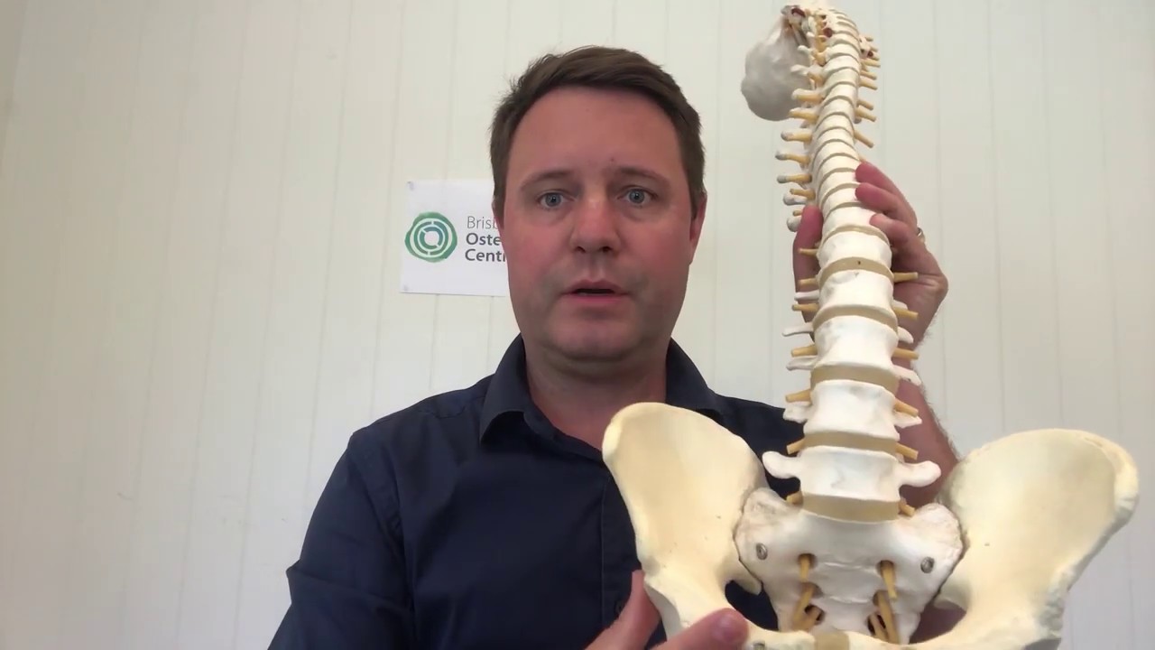 Dr Scott Baxter, osteopath talks about Sciatica