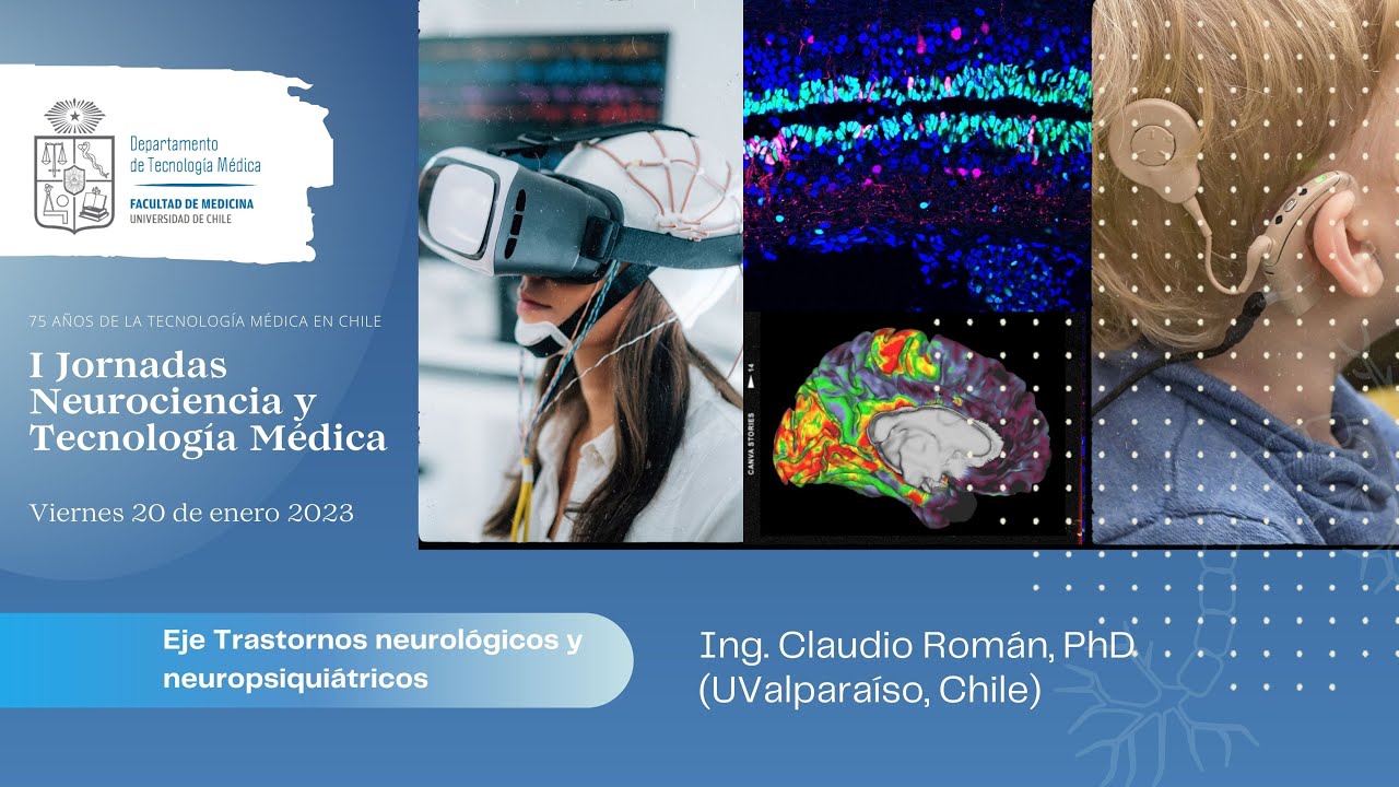 M&eacute;todos para el an&aacute;lisis de fibras cerebrales calculadas a partir de tractograf&iacute;a - Claudio Rom&aacute;n