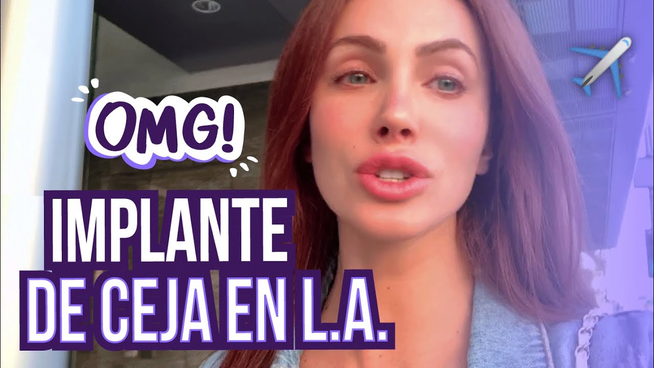 IMPLANTE DE CEJA @LOS ÁNGELES | Ana Bekoa