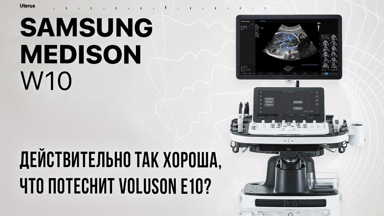 Samsung Medison W10 альтернатива Voluson E10?