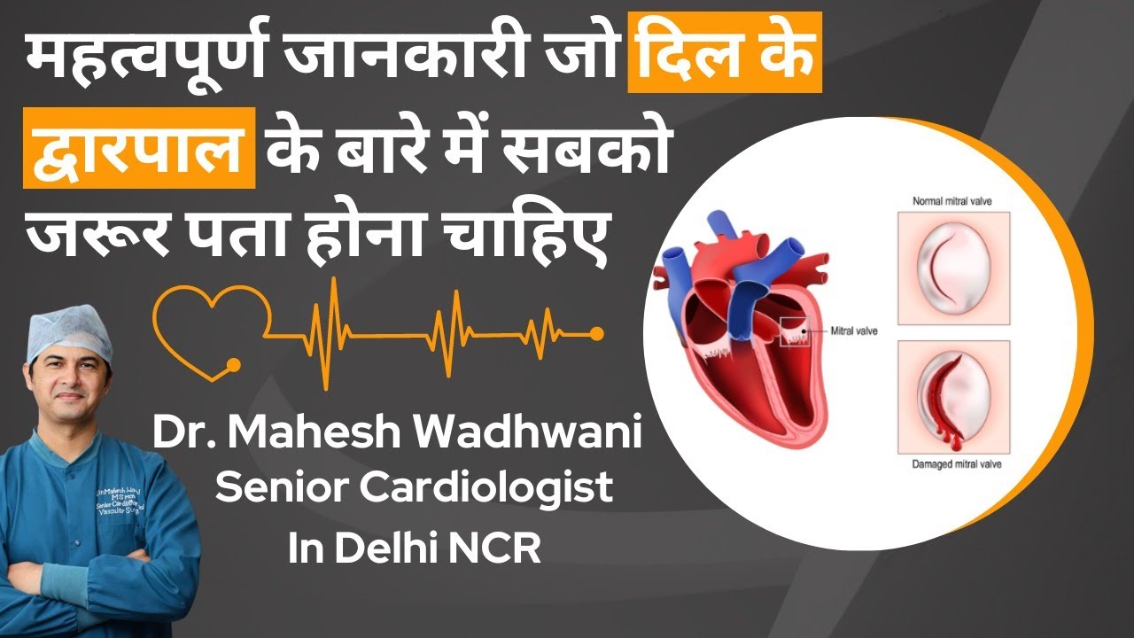 Mitral Valve Procedure के बारे में सटीक जानकारी l Mitral Valve Surgery l Stenosis Regurgitation